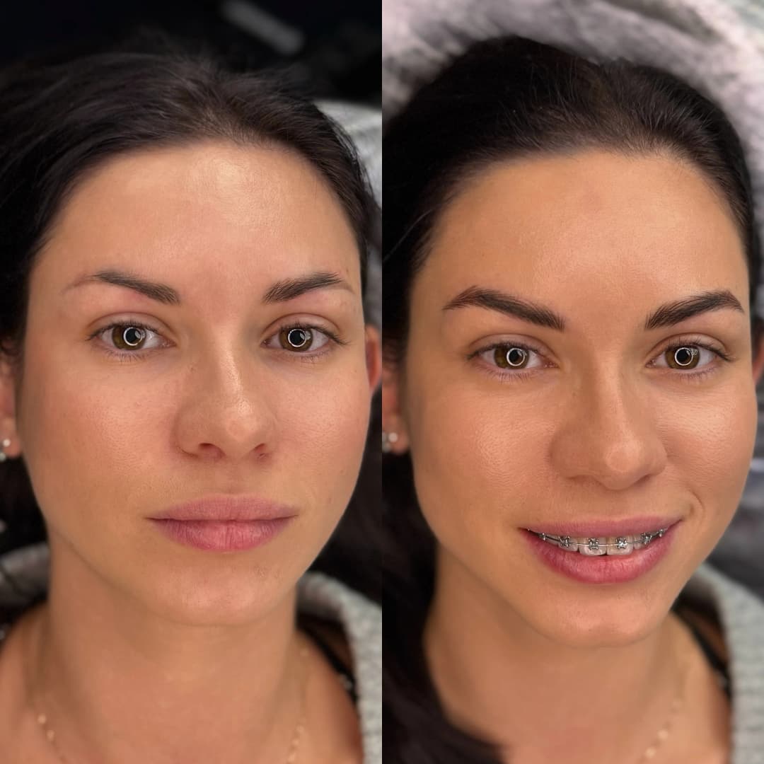 Nano Hair Stroke Eyebrows 7